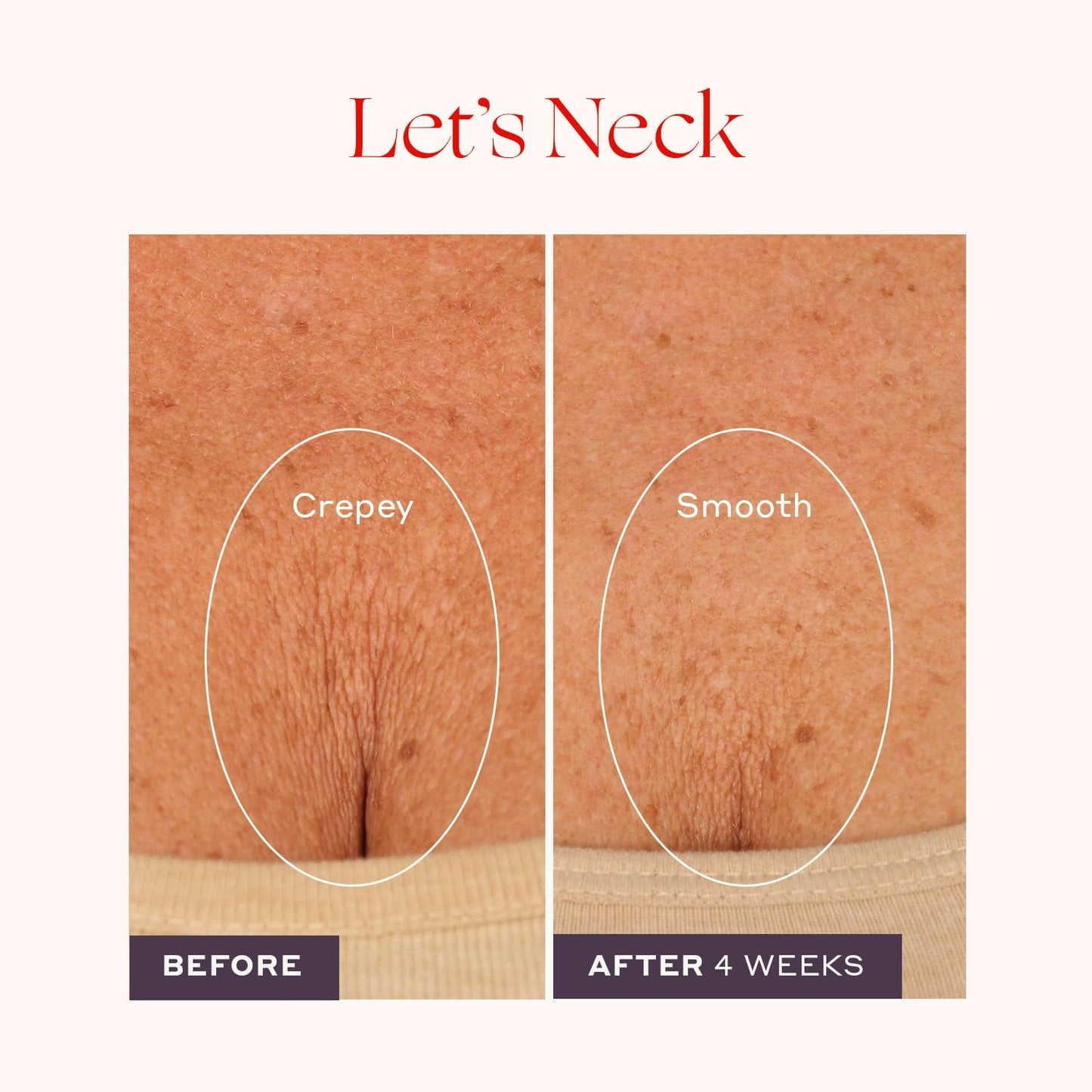 Womaness Let’s Neck Firming Serum 50 ml – Cooling Roller for Hydration, Firming & Smooth Neck Skin