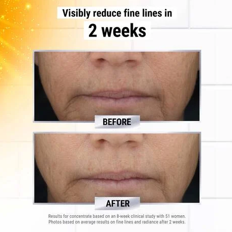 Kiehl's Powerful-Strength 12.5% Vitamin C Serum – Line-Reducing Concentrate with Hyaluronic Acid for Radiant, Smooth & Firm Skin