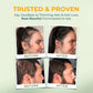 Vital Hair Complex – Biotin & Vitamin B Hair Vitamins for Women & Men